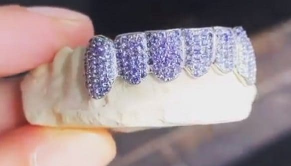 Diamond Tooth Rapper Something to Chew On: Rapper Spends $1.6 Million on “Diamond Teeth ...